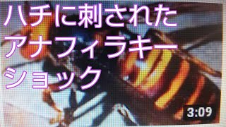 ハチに刺され38歳男性死亡‼️ 草刈り作業中に‼️ アナフィラキシーショックか‼️😭