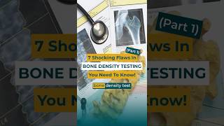 (PART 1)  Got DEXA? TOP 7 Problems With BONE DENSITY TESTING