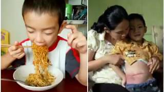 Viral..... gara gara terlalu banyak makan mie instan anak ini harus.......