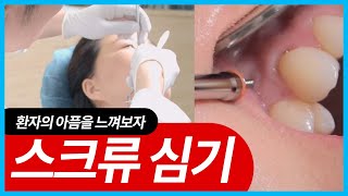 스크류를  왜 아프다 하는지 모르겠다길래, 제가 심어줬습니다. 환자의 마음을 알라!! (치아교정, 스크류교정)