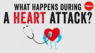 What Happens During A Heart Attack - Krishna Sudhir
