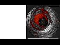 case 151 pci manual downward spiral