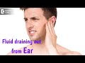 Fluid coming out from Ear | Is it pus? Best Treatment - Dr. Harihara Murthy |Doctors' Circle