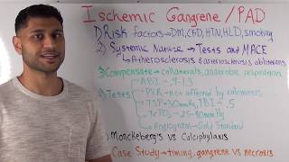 Residency Interview Case Study - Ischemic Gangrene / Peripheral Arterial Disease