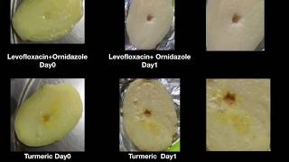 Microbiology At Home || Bacteria against Antibiotics, Resistant or Susceptible?