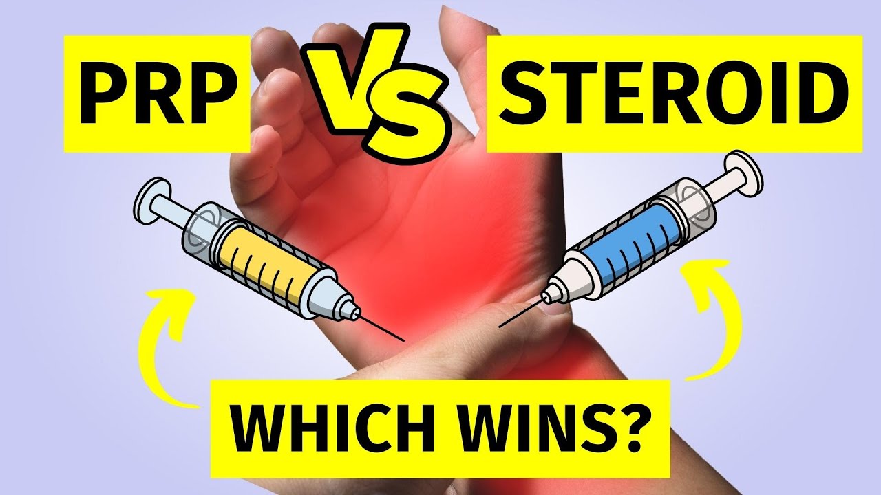 Carpal Tunnel Syndrome Injections: PRP Vs Steroid Vs Dextrose Prolotherapy