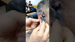 ازاله شعر الاذن بالشمع 💈✂️😂 #fun #funny #fyp #viralvideo #foryou #comedy #funnyvideo