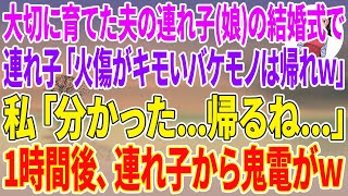 【スカッとする話】10年間大切に育てた夫の連れ子（娘）の結婚式当日、顔に火傷を負った私に連れ子「火傷がキモいバケモノは帰れw」私「分かった…帰るね…」1時間後、連れ子から鬼電がw