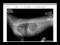 Tracheal Collapse in Dogs