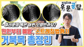 [우문공답] #거북목 에 대한 모든 것! 이 영상 하나에 담았습니다!!! - 거북목 총정리 #23