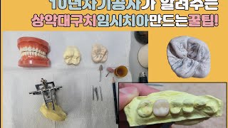 상악대구치 임시치아(템포러리) 형태잡는방법, 빨리 잘만드는 꿀팁 알려드릴께요^^