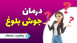 جوش دوران بلوغ و راهکارهای درمان آن