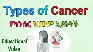 Types of cancer | የካንሰር ህመም እንዴት ይከሰታል እንዴስ መከላከል እንችላለን