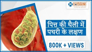 पित्त की थैली के लक्षण - Gall Bladder Stone Symptoms in Hindi | Dr. Subrat Saxena