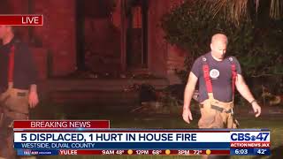 5 displaced, 1 hurt after Jacksonville house fire