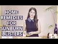How To Get Rid Of Sunburn Blisters At Home How To Get Rid Of Sunburn Blisters At Home