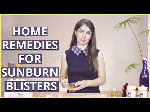 How To Get Rid Of Sunburn Blisters At Home How To Get Rid Of Sunburn Blisters At Home