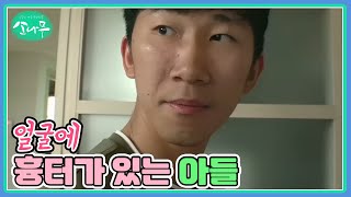 과거에 칼에 베여서 얼굴에 흉터가 생긴 아들 MBN 240617 방송