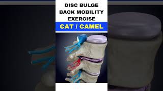 Disc Bulge and Back Pain Mobility Exercises Cat Camel Dr. Walter Salubro # Shorts