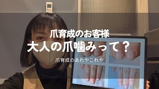 大人の爪噛み癖、やめたいけどやめられない・・やめる方法があります！【爪育成についてのお話】