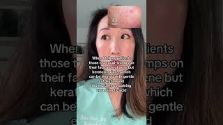 Those Tiny Bumps on Your Face? It’s KP, Not Acne – Here’s What to Do