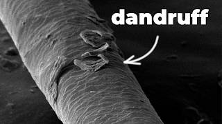 Dandruff under the microscope 1000x