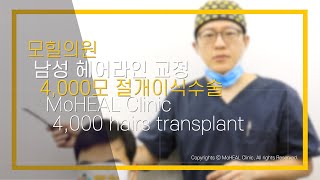 [모힐TV] 남성 헤어라인 교정! 고밀도 이식할 때 꼭 알아야 할 것들