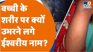 Hardoi: बच्ची के शरीर पर Ram-Ram और Radhe-Radhe शब्द उभरने से Doctor हैरान। TV9UPUK