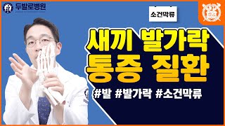 [발가락통증] 새끼발가락의 통증과 변형, 소건막류의 원인과 치료