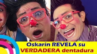 Oskarín REVELA su VERDADERA dentadura y deja A TODOS EN SHOCK