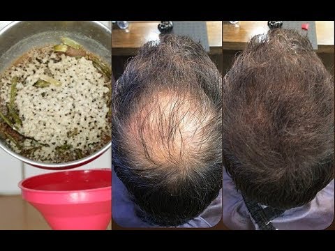 YOUR HAIR WILL GROW LIKE CRAZY- GROW HAIR Long, Thick & Healthy FAST! YOUR HAIR WILL GROW LIKE CRAZY- GROW HAIR Long, Thick & Healthy FAST!