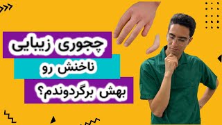 پروتز انگشت | قطع عضو  | هنر پروتز |پروتز سلیب | پروتز سیلیکونی | انگشت مصنوعی | پروتز |