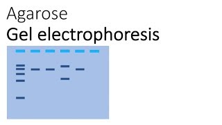 Agarose Gel Electrophoresis