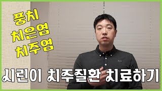 시린이의 원인 치주염, 치은염 집에서 치료하기 Periodontitis