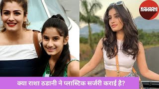 Rasha Thadani Plastic Surgery | क्या राशा ने nose surgery कराई है?