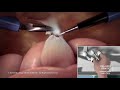 orlando health advanced robotic surgery center robotic surgery overview female