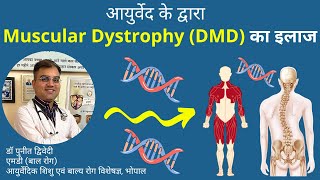 आयुर्वेद के द्वारा Muscular Dystrophy (DMD) का इलाज | डॉ पुनीत द्विवेदी