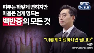 [메디컬 라이브] 얼룩덜룩 잃어가는 피부색을 되찾기 위한 노력! 백반증의 발병 원인부터 치료법까지!ㅣ메디컬 인사이트 / YTN2U