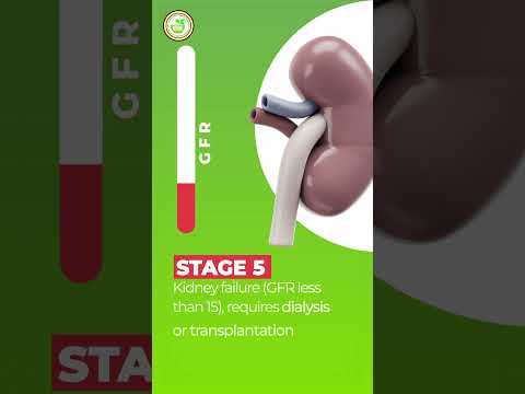 5 stages of chronic kidney failure for better health management | Hakeem Dr Yasir Arafath