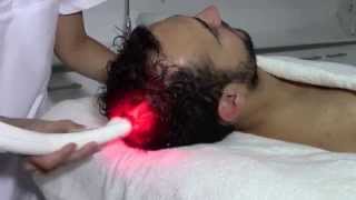 Electroporation for hair loss