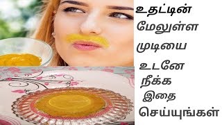 Upper lip hair removal at home in tamil /  மேல் உதட்டில் முடி வளராமல் தடுப்பது