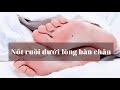 Sở hữu NỐT RUỒI DƯỚI LÒNG BÀN CHÂN cả đời bạn sẽ sung túc