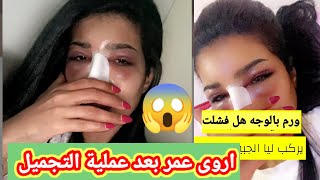 لن تصدق كيف اصبح وجه اروى عمر بعد عملية التجميل في أول ظهور