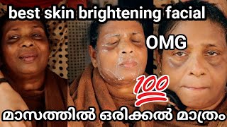 മുഖം കരിവാളിച്ചു ഇരിക്കുബോൾ ഞാൻചെയ്യുന്ന Quick lightening secret Tan Removel  Natural method at Home