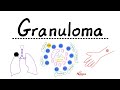 Granuloma - Caseating, Non-caseating, Epithelioid Cells (Histiocytes) - Tuberculoma, Leproma Gumma