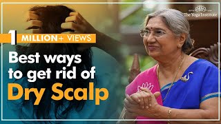 Treat Dry Scalp at Home | Dr. Hansaji Yogendra