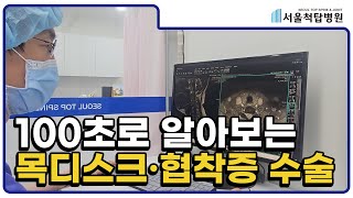 100초로 알아보는 목디스크 협착증 내시경수술 [재업]