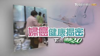 女性健康殺手【婦癌健康揭密】特別報導