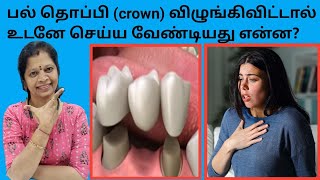 பல் விழுங்கி விட்டால் உடனே செய்ய வேண்டிய விஷயம் என்ன ? - [what to do if dental crowns are swallowed]