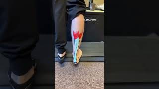 How to strengthen the Achilles tendon